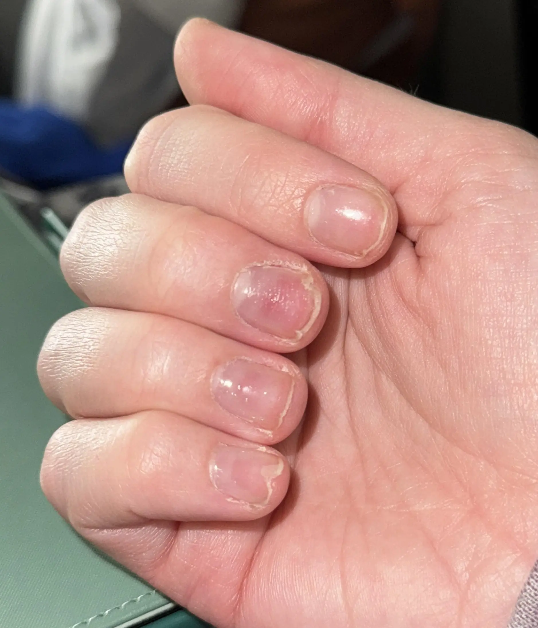 تقویت-کننده-ناخن-پلاس-رسپینا nail gel damage